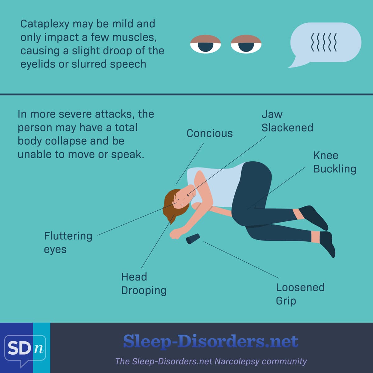 Cataplexy, commonly associated with narcolepsy, can affect a few muscles or cause total body collapse