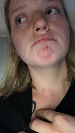 Advocate Tara O'Connor showing bruises and scrapes on her chin and neck